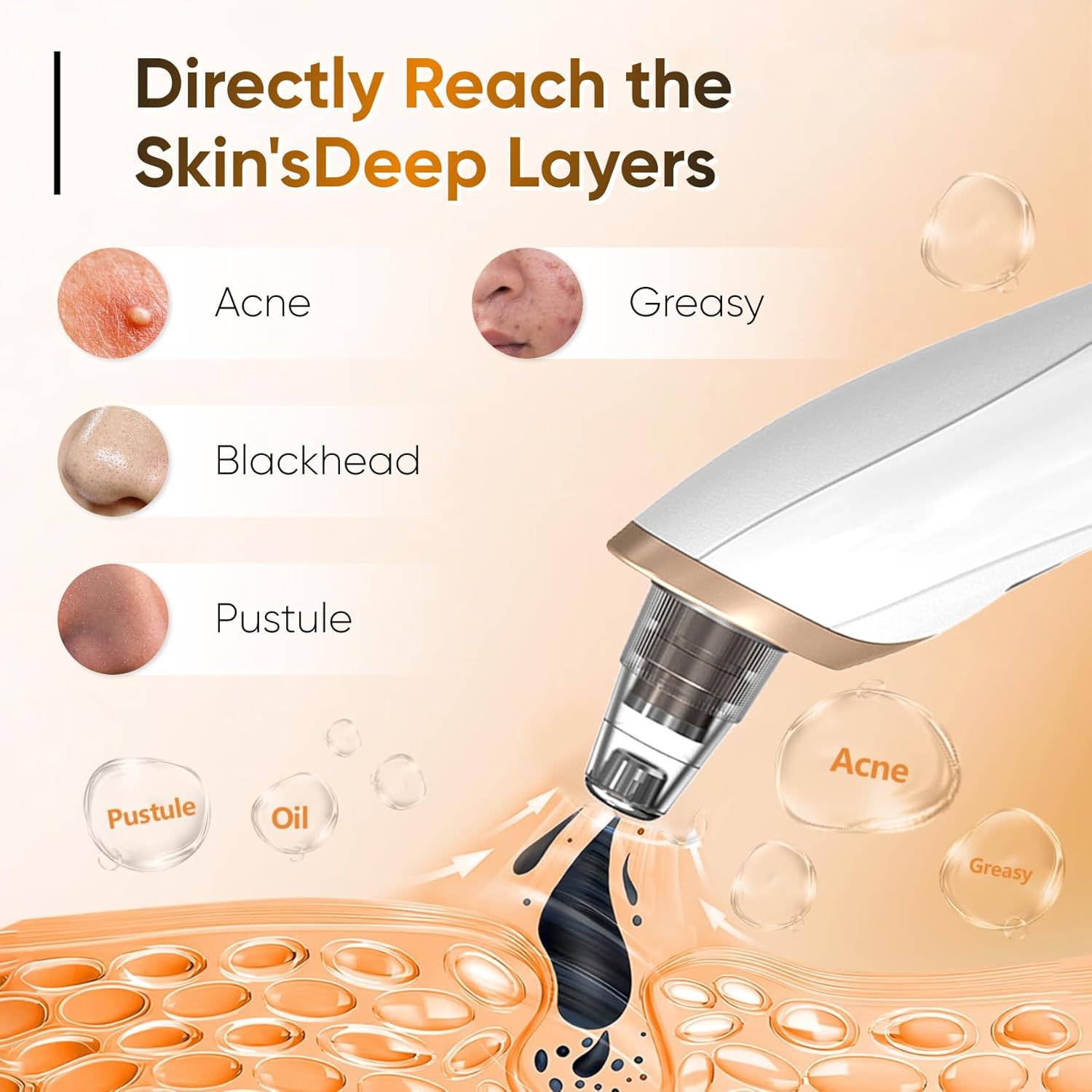 Blackhead Remover